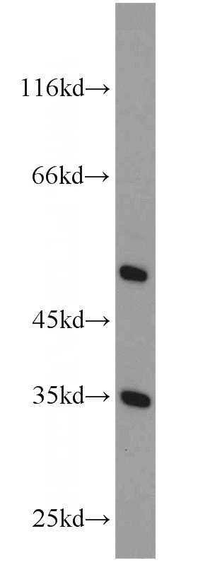 L02 cells were subjected to SDS PAGE followed by western blot with Catalog No:108319(ATPAF1 antibody) at dilution of 1:1500