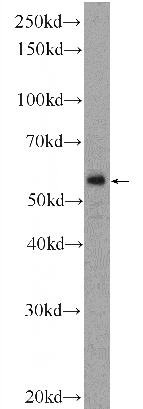 human placenta tissue were subjected to SDS PAGE followed by western blot with Catalog No:110431(F7 Antibody) at dilution of 1:300