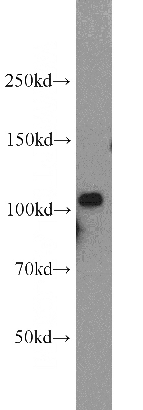 HeLa cells were subjected to SDS PAGE followed by western blot with Catalog No:108000(AMOTL1 antibody) at dilution of 1:500