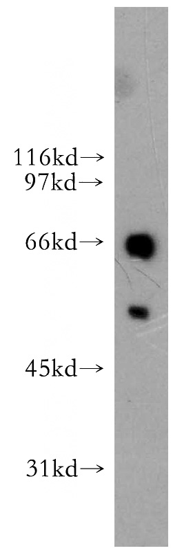 A431 cells were subjected to SDS PAGE followed by western blot with Catalog No:110490(ETV6 antibody) at dilution of 1:1000
