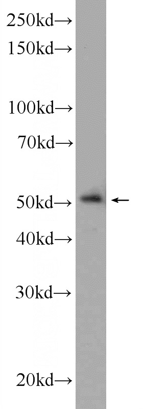 PC-3 cells were subjected to SDS PAGE followed by western blot with Catalog No:112312(LPXN Antibody) at dilution of 1:600
