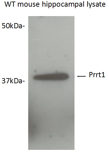 WB result of PRRT1 antibody (Catalog No:114278) with mouse hippocampal tissue lysate. (Image courtesy of Dr. I. Kaur and Dr. E. Diaz, UC Davis)
