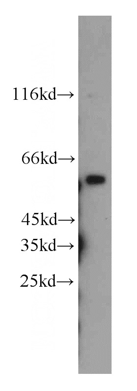 Raji cells were subjected to SDS PAGE followed by western blot with Catalog No:109418(MYC antibody) at dilution of 1:1000