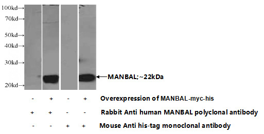 Transfected HEK-293 cells were subjected to SDS PAGE followed by western blot with Catalog No:112466(MANBAL Antibody) at dilution of 1:1000