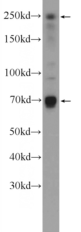 HEK-293 cells were subjected to SDS PAGE followed by western blot with Catalog No:110264(EIF4G3 Antibody) at dilution of 1:600