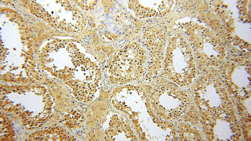 Immunohistochemical of paraffin-embedded human testis using Catalog No:116881(YARS2 antibody) at dilution of 1:100 (under 10x lens)
