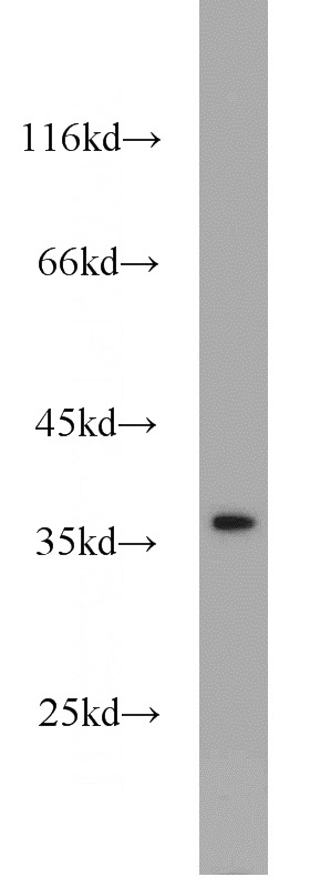 HeLa cells were subjected to SDS PAGE followed by western blot with Catalog No:116389(NKX2-1 antibody) at dilution of 1:1000