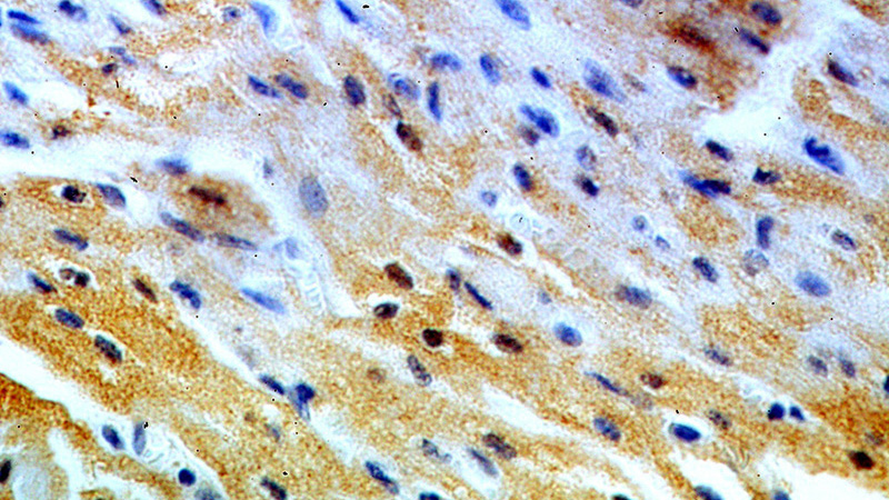 Immunohistochemical of paraffin-embedded human heart using Catalog No:108024(APOBEC2 antibody) at dilution of 1:100 (under 40x lens)
