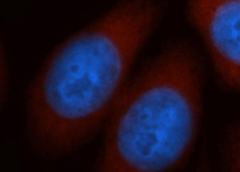 Immunofluorescent analysis of Hela cells, using NCAPD2 antibody Catalog No:113029 at 1:50 dilution and Rhodamine-labeled goat anti-rabbit IgG (red). Blue pseudocolor = DAPI (fluorescent DNA dye).