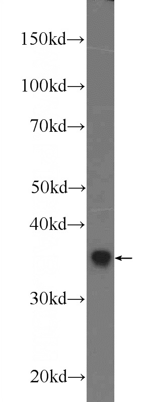 mouse liver tissue were subjected to SDS PAGE followed by western blot with Catalog No:109777(DDRGK1 Antibody) at dilution of 1:600