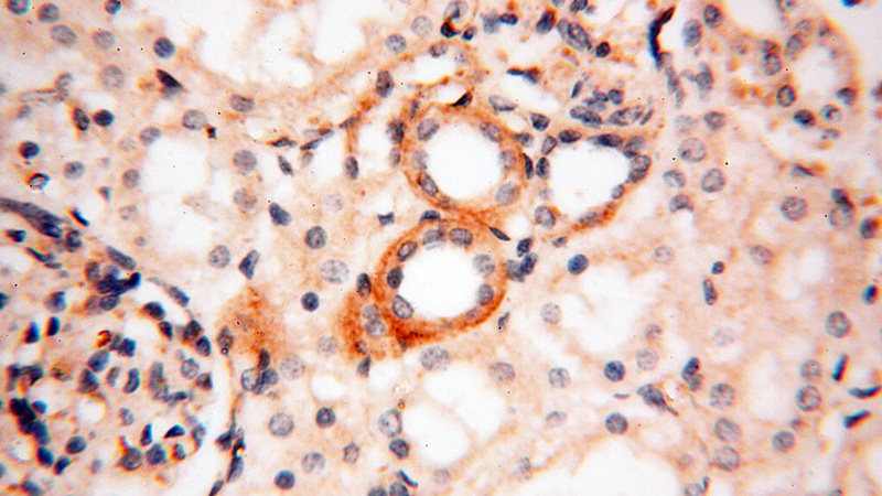 Immunohistochemical of paraffin-embedded human kidney using Catalog No:113542(P2RX4 antibody) at dilution of 1:100 (under 40x lens)