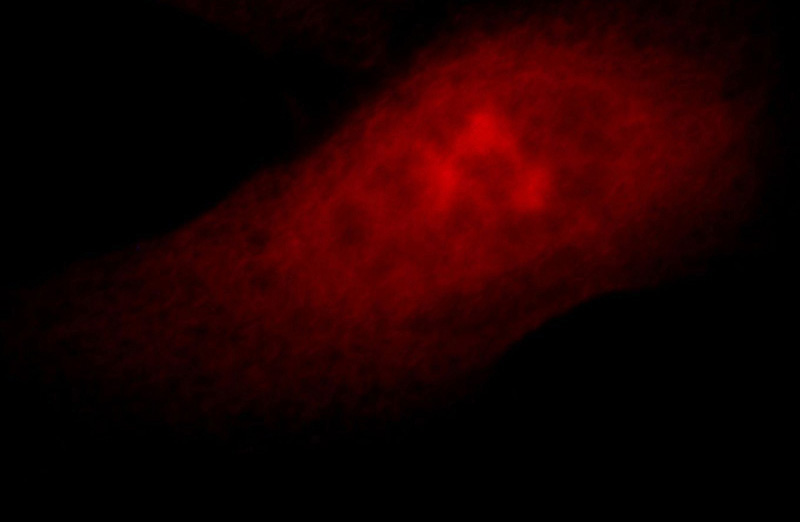Immunofluorescent analysis of Hela cells, using ZNF622 antibody Catalog No:117013 at 1:25 dilution and Rhodamine-labeled goat anti-rabbit IgG (red).