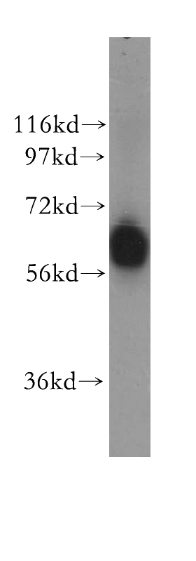 human lung tissue were subjected to SDS PAGE followed by western blot with Catalog No:111239(GTF3C5 antibody) at dilution of 1:600