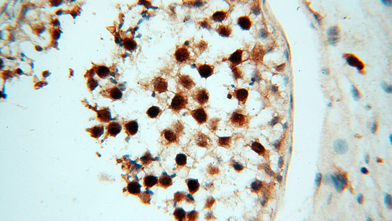 Immunohistochemical of paraffin-embedded human testis using Catalog No:114540(RANBP9 antibody) at dilution of 1:50 (under 40x lens)