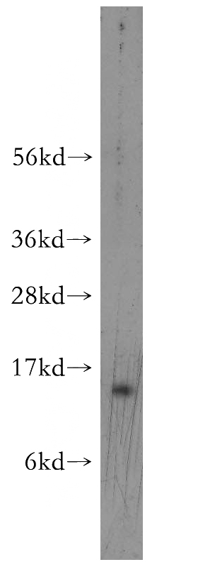 Jurkat cells were subjected to SDS PAGE followed by western blot with Catalog No:112803(MRFAP1 antibody) at dilution of 1:400