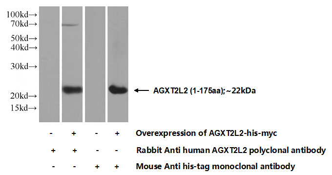 Transfected HEK-293 cells were subjected to SDS PAGE followed by western blot with Catalog No:107841(AGXT2L2 Antibody) at dilution of 1:1000