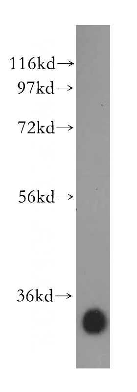 human liver tissue were subjected to SDS PAGE followed by western blot with Catalog No:117112(BDH1 antibody) at dilution of 1:500