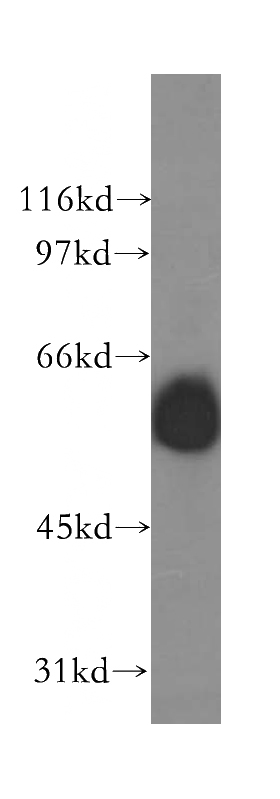 mouse eye tissue were subjected to SDS PAGE followed by western blot with Catalog No:110812(GABRG1 antibody) at dilution of 1:600