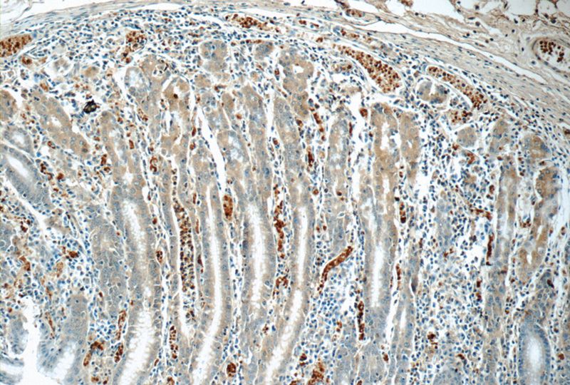 Immunohistochemistry of paraffin-embedded human stomach tissue slide using Catalog No:108147(ARL8B Antibody) at dilution of 1:50 (under 10x lens)