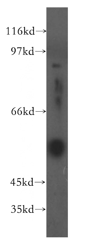 human spleen tissue were subjected to SDS PAGE followed by western blot with Catalog No:110657(FGG antibody) at dilution of 1:400