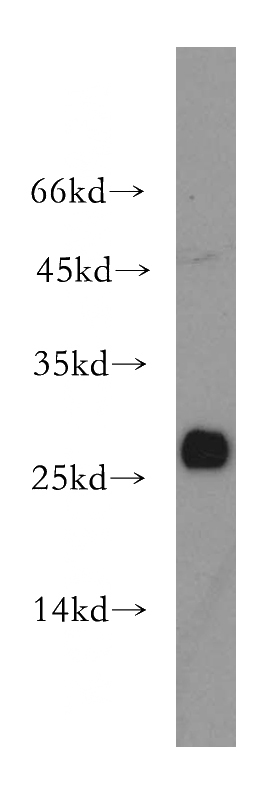 Jurkat cells were subjected to SDS PAGE followed by western blot with Catalog No:111189(GSTO1 antibody) at dilution of 1:500