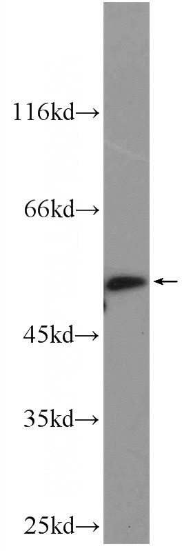 U-937 cells were subjected to SDS PAGE followed by western blot with Catalog No:111617(IFIT1 Antibody) at dilution of 1:600