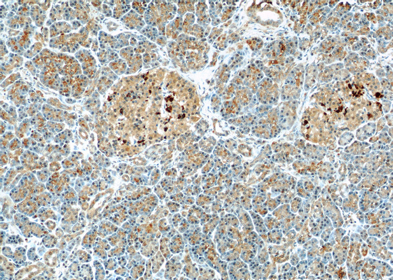 Immunohistochemistry of paraffin-embedded human pancreas slide using Catalog No:111644(IKBKB Antibody) at dilution of 1:50