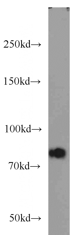 mouse kidney tissue were subjected to SDS PAGE followed by western blot with Catalog No:112198(LEPREL1 antibody) at dilution of 1:600