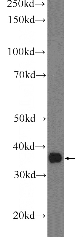 mouse liver tissue were subjected to SDS PAGE followed by western blot with Catalog No:107692(ACPT Antibody) at dilution of 1:1000