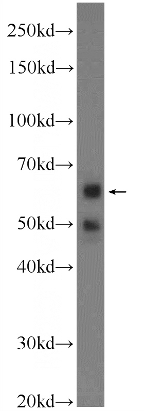 K-562 cells were subjected to SDS PAGE followed by western blot with Catalog No:114099(PPP2R2A Antibody) at dilution of 1:300