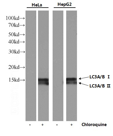 Western Blot analysis of MAP1LC3A/B in HeLa and HepG2 cells untreated/treated with 50μM chloroquine overnight using Catalog No:107373 (MAP1LC3A/B monoclonal antibody) at dilution of 1:1000.