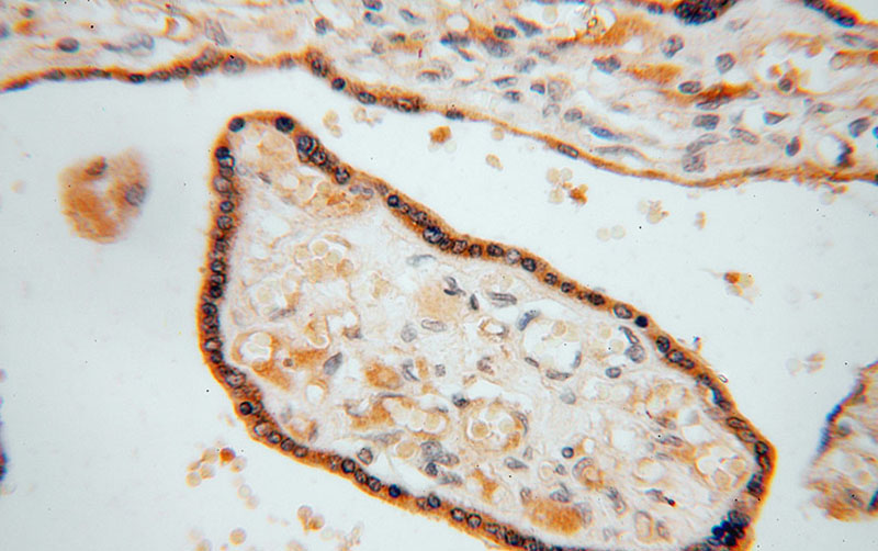 Immunohistochemical of paraffin-embedded human placenta using Catalog No:116295(TRIB2 antibody) at dilution of 1:50 (under 40x lens)