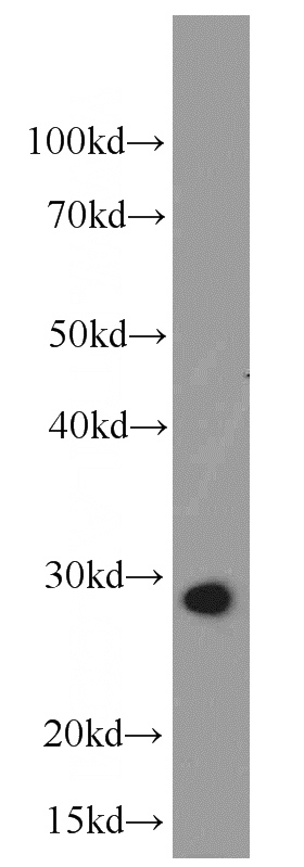 mouse skeletal muscle tissue were subjected to SDS PAGE followed by western blot with Catalog No:116546(UCP2 antibody) at dilution of 1:1000