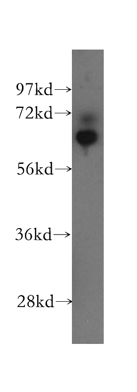 Raji cells were subjected to SDS PAGE followed by western blot with Catalog No:110101(DNAJC1 antibody) at dilution of 1:300