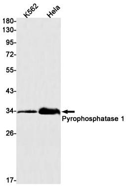 Western blot detection of Pyrophosphatase 1 in K562,Hela cell lysates using Pyrophosphatase 1 Rabbit mAb(1:1000 diluted).Predicted band size:33kDa.Observed band size:33kDa.
