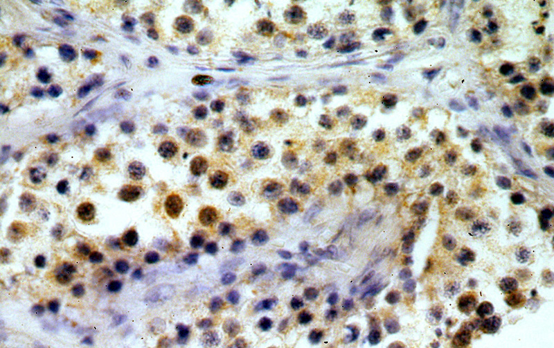 Immunohistochemical of paraffin-embedded human testis using Catalog No:115982(TAF1B antibody) at dilution of 1:200 (under 40x lens)