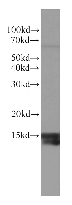 human brain tissue were subjected to SDS PAGE followed by western blot with Catalog No:107373(LC3A/B antibody) at dilution of 1:1000
