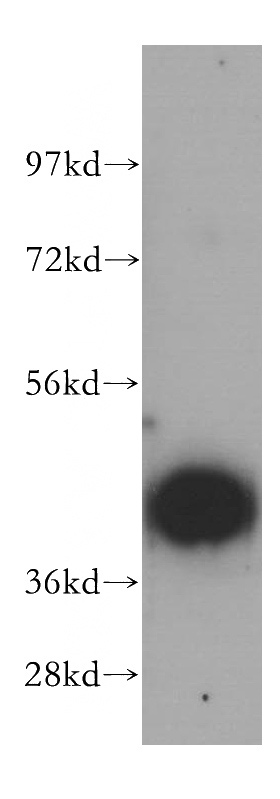 HepG2 cells were subjected to SDS PAGE followed by western blot with Catalog No:114983(SCAMP2 antibody) at dilution of 1:500
