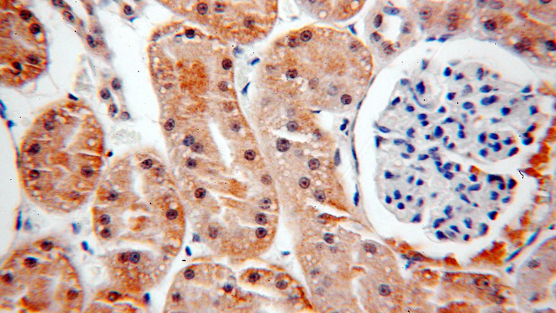 Immunohistochemical of paraffin-embedded human kidney using Catalog No:115511(SOX13 antibody) at dilution of 1:100 (under 40x lens)