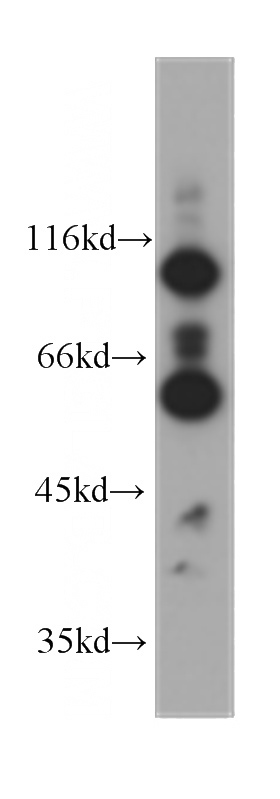 HeLa cells were subjected to SDS PAGE followed by western blot with Catalog No:107354(IRF5 antibody) at dilution of 1:1000