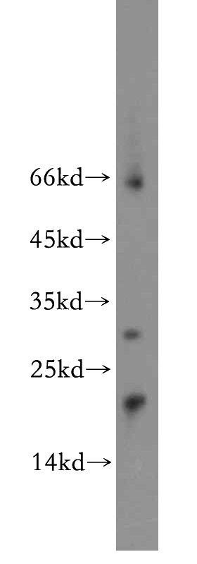 mouse cerebellum tissue were subjected to SDS PAGE followed by western blot with Catalog No:113361(NUDT3 antibody) at dilution of 1:800