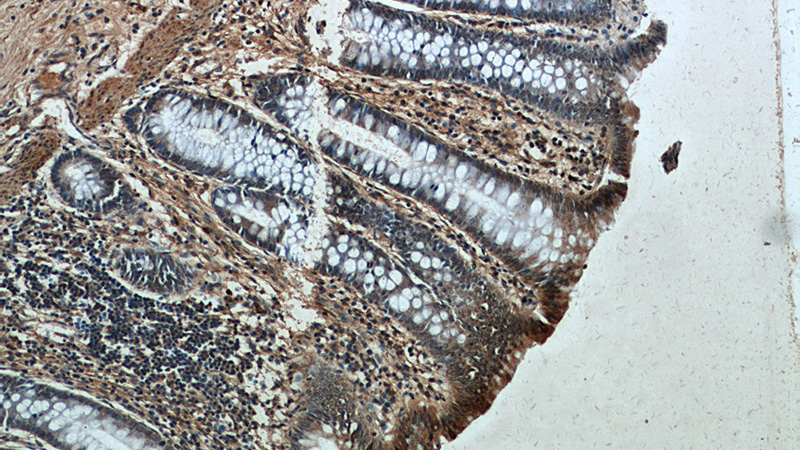 Immunohistochemical of paraffin-embedded human colon using Catalog No:113968(PLK1-phospho antibody) at dilution of 1:50 (under 10x lens)