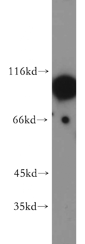 HEK-293 cells were subjected to SDS PAGE followed by western blot with Catalog No:111726(DLGAP5 antibody) at dilution of 1:500