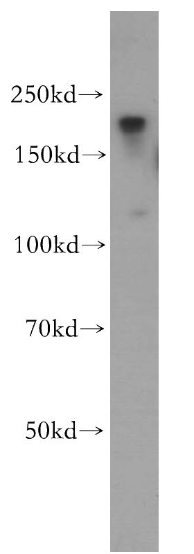MCF7 cells were subjected to SDS PAGE followed by western blot with Catalog No:116932(ZCCHC11 antibody) at dilution of 1:500