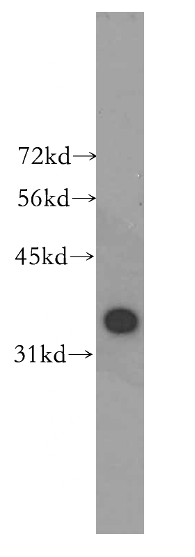K-562 cells were subjected to SDS PAGE followed by western blot with Catalog No:112386(MAGEB4 antibody) at dilution of 1:300