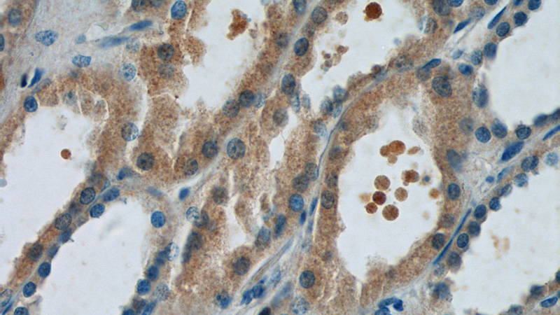 Immunohistochemistry of paraffin-embedded human kidney tissue slide using Catalog No:110522(FANCL Antibody) at dilution of 1:50 (under 40x lens)