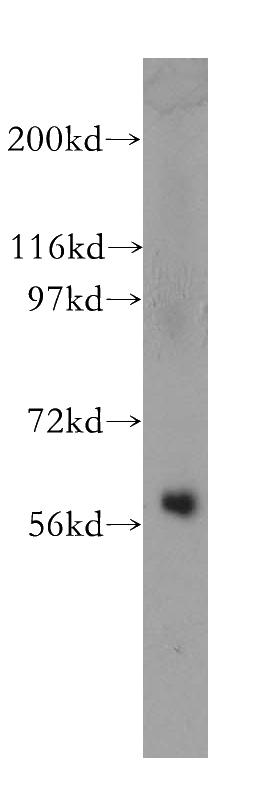 human kidney tissue were subjected to SDS PAGE followed by western blot with Catalog No:115114(SEPT10 antibody) at dilution of 1:800