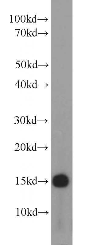 HeLa cells were subjected to SDS PAGE followed by western blot with Catalog No:113180(NHP2L1 antibody) at dilution of 1:1000