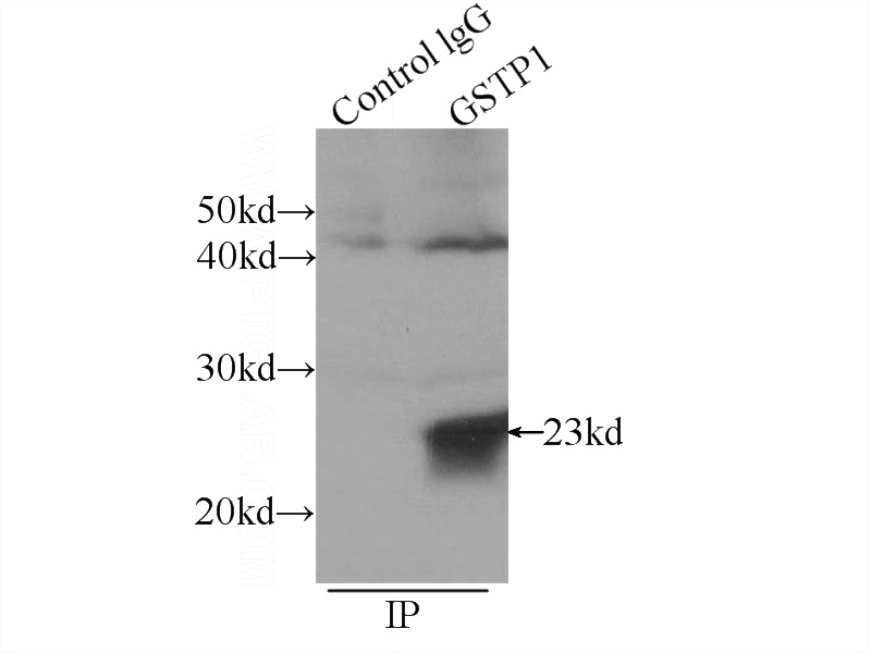 IP Result of anti-GSTP1 (IP:Catalog No:111191, 3ug; Detection:Catalog No:111191 1:800) with mouse brain tissue lysate 4000ug.