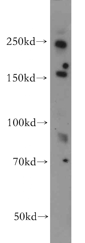 human brain tissue were subjected to SDS PAGE followed by western blot with Catalog No:111990(KIAA1199 antibody) at dilution of 1:500